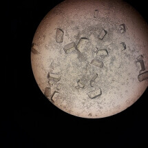 Laboratorija sediment mokrace 