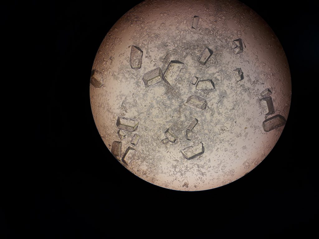 Laboratorija sediment mokrace