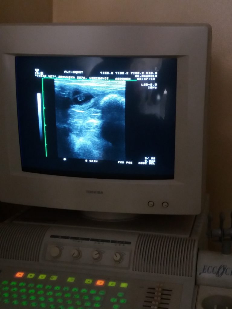 Ultrazvučna dijagnostika graviditeta