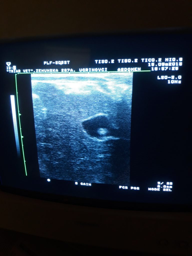 Ultrazvuk kamen u žučnoj kesi