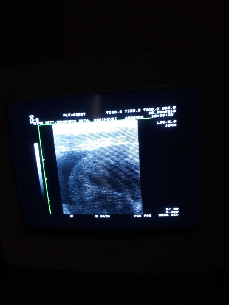 Ultrazvuk slobodna tečnost oko bubrega