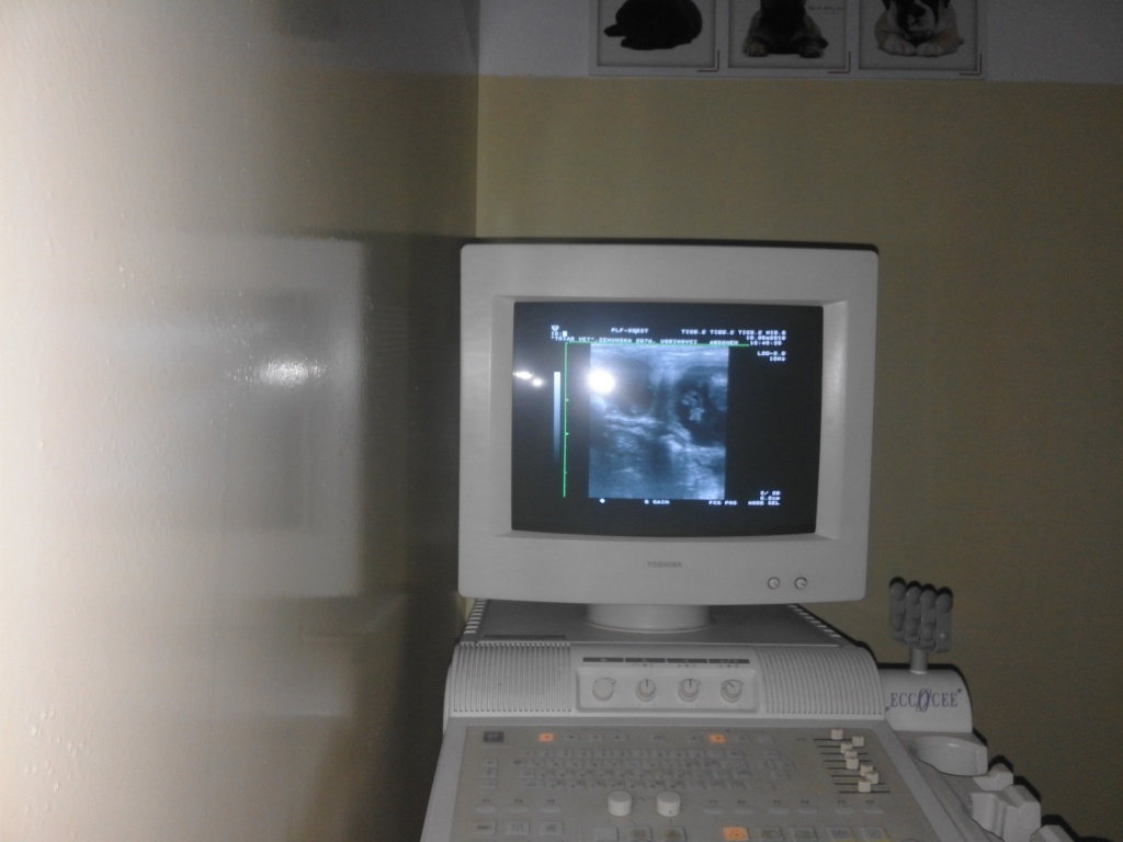 ultrazvucna dijagnostika graviditeta